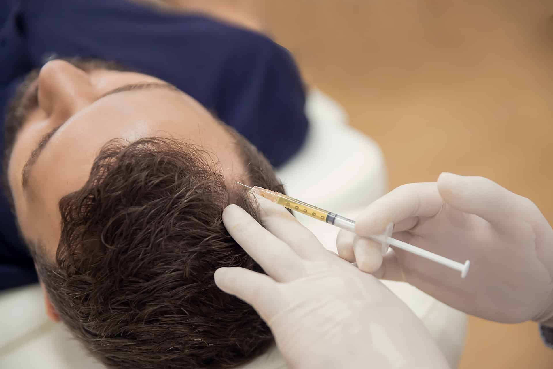 Hair mesotherapy or scalp prp: Platelet-rich plasma procedure. Beautician doctor makes injections in the man head for hair growth against hair loss and baldness
